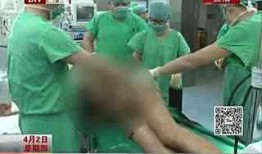 吃瓜后头晕呕吐原因,原因及预防措施